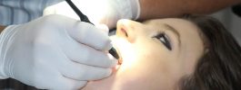Corregir dientes torcidos y maloclusiones dentales